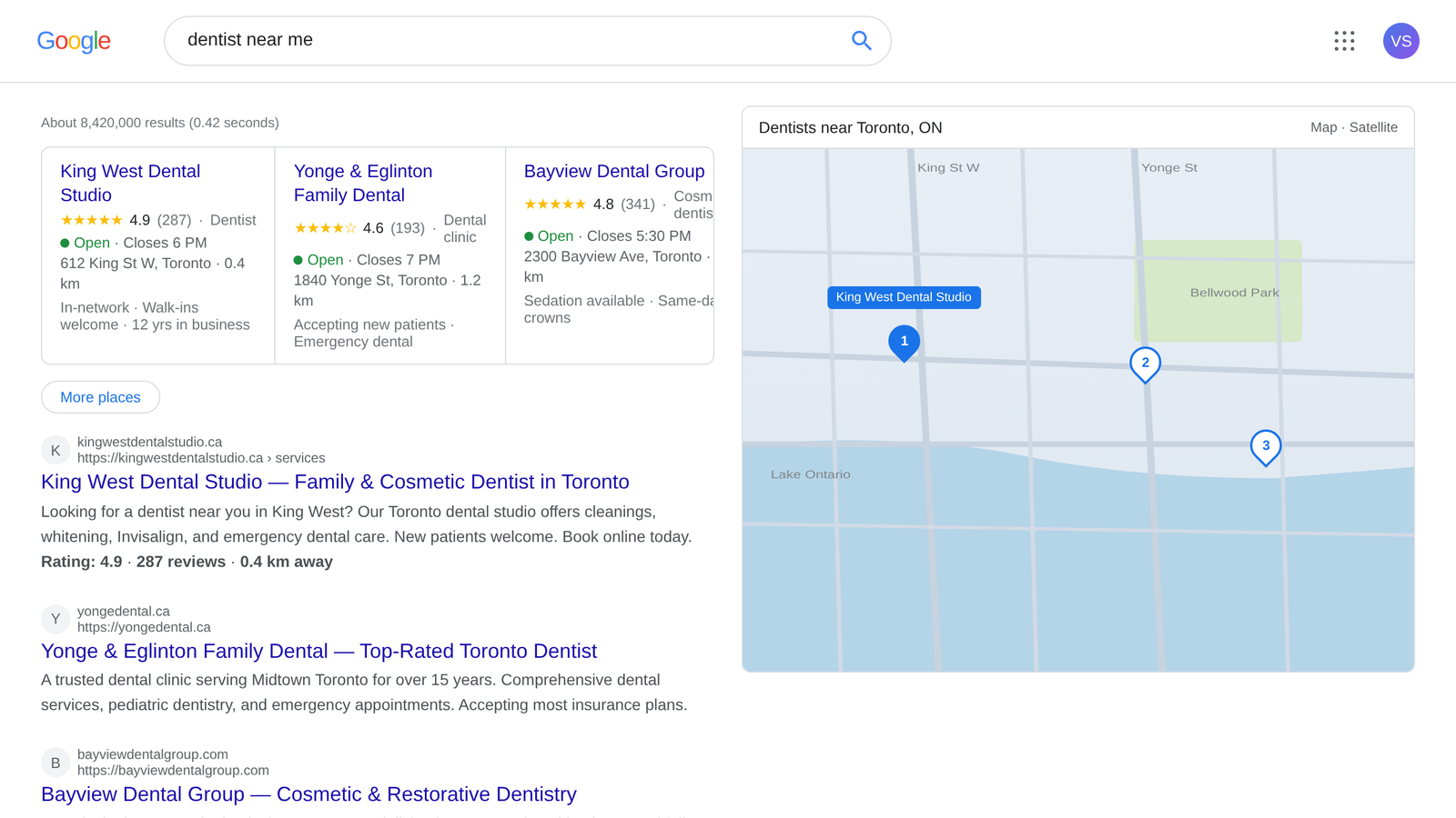 What Is Local SEO and How Does It Work? 1 SERPs Local Pack for dentist near me